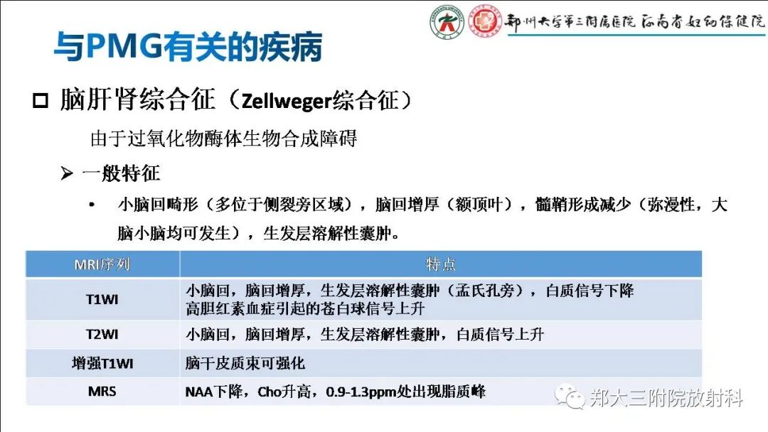 【PPT】多小脑回畸形的影像表现-15