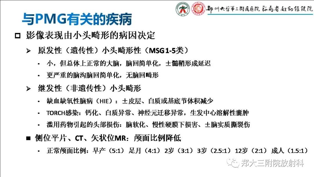 【PPT】多小脑回畸形的影像表现-19