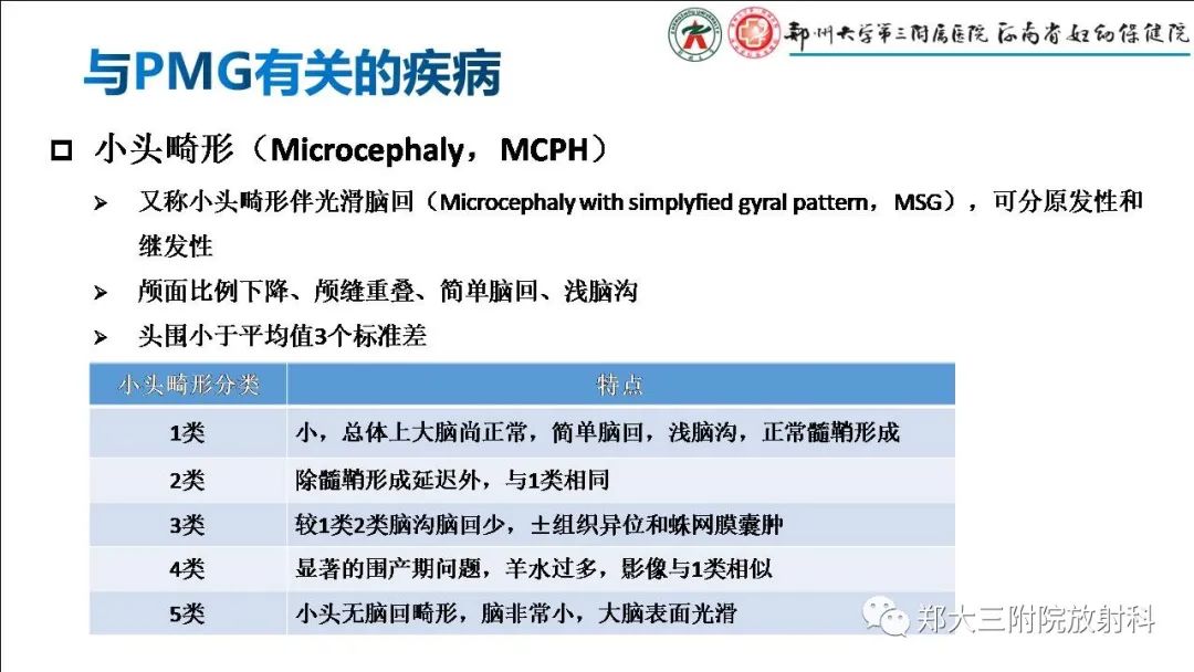 【PPT】多小脑回畸形的影像表现-18