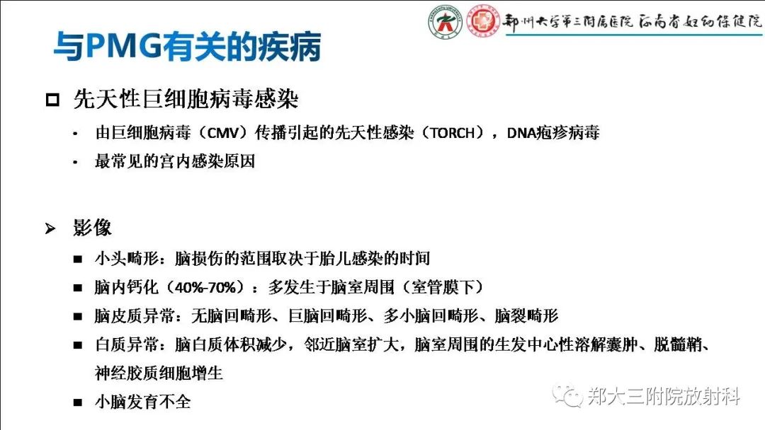 【PPT】多小脑回畸形的影像表现-25