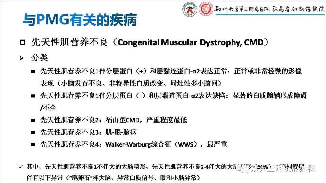 【PPT】多小脑回畸形的影像表现-31