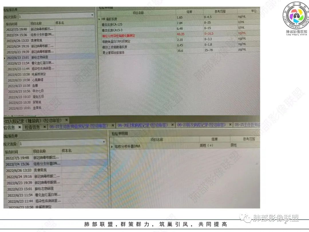 【病例】肺部硕大块影一定想到它！-3