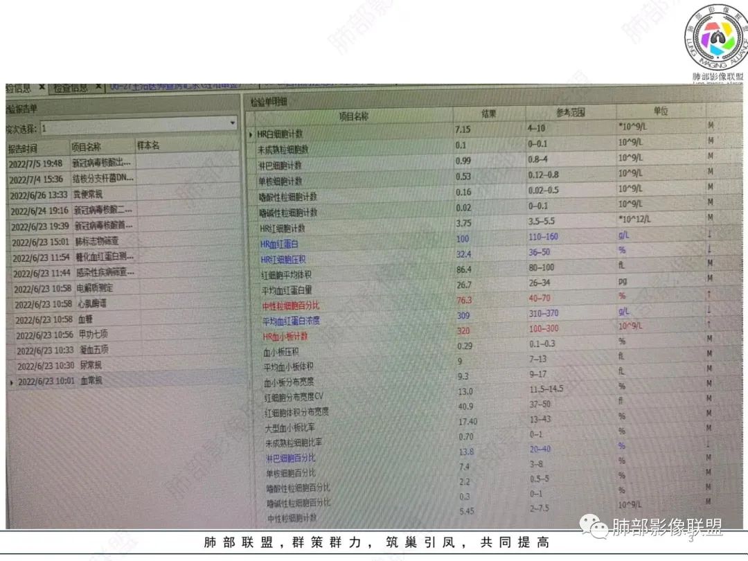 【病例】肺部硕大块影一定想到它！-4