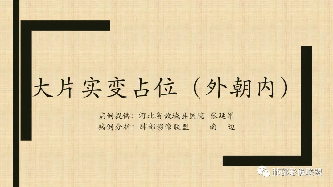 【病例】肺部硕大块影一定想到它！-58