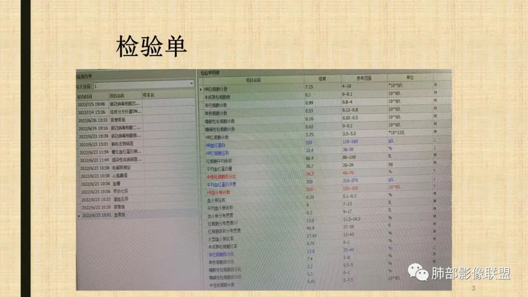 【病例】肺部硕大块影一定想到它！-60