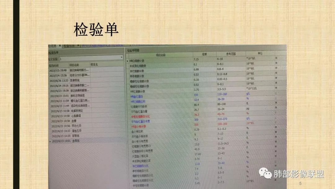 【病例】肺部硕大块影一定想到它！-62