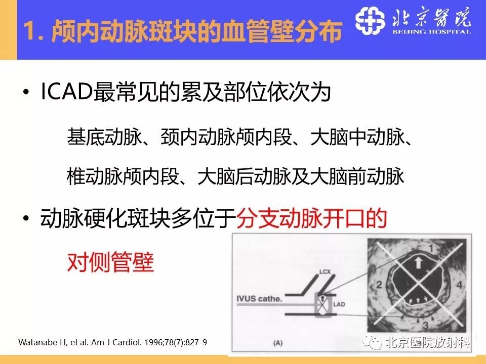 【PPT】HRMRI在缺血性脑卒中精准病因诊断中的应用-21