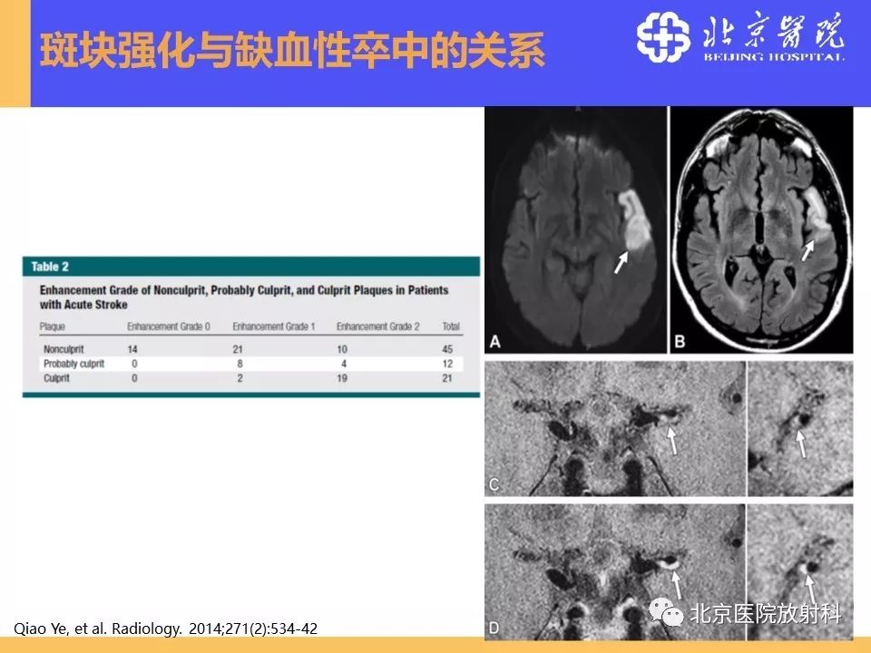 【PPT】HRMRI在缺血性脑卒中精准病因诊断中的应用-41