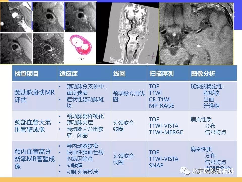 【PPT】HRMRI在缺血性脑卒中精准病因诊断中的应用-78