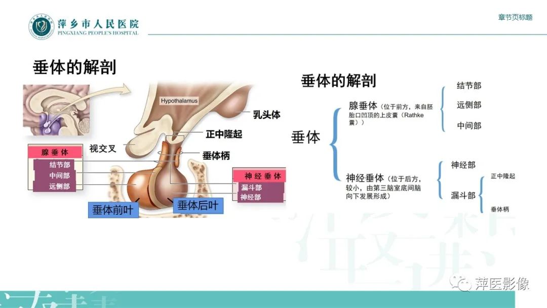 【PPT】垂体常见病变-3