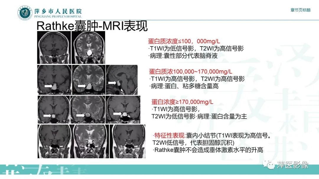 【PPT】垂体常见病变-9