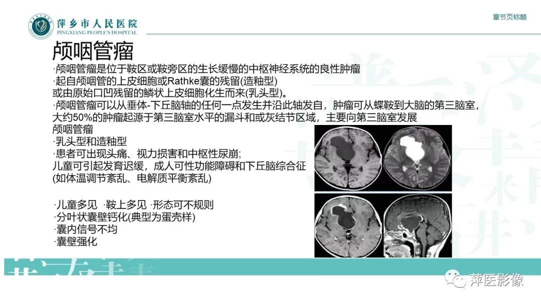 【PPT】垂体常见病变-16