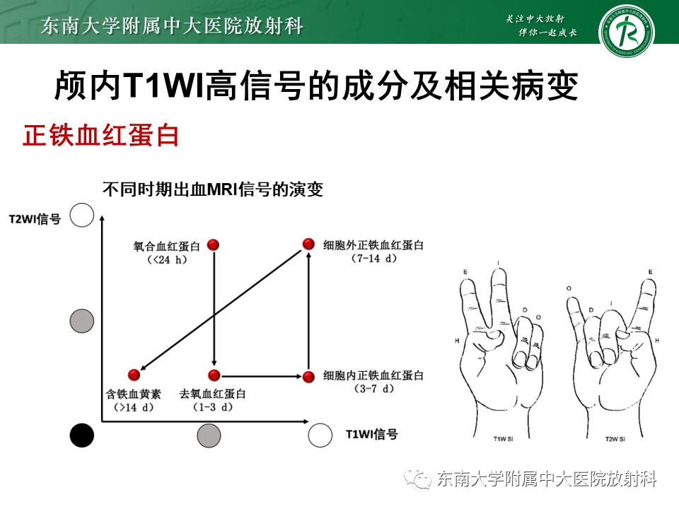 【PPT】成人颅内T1WI高信号病例随访-24