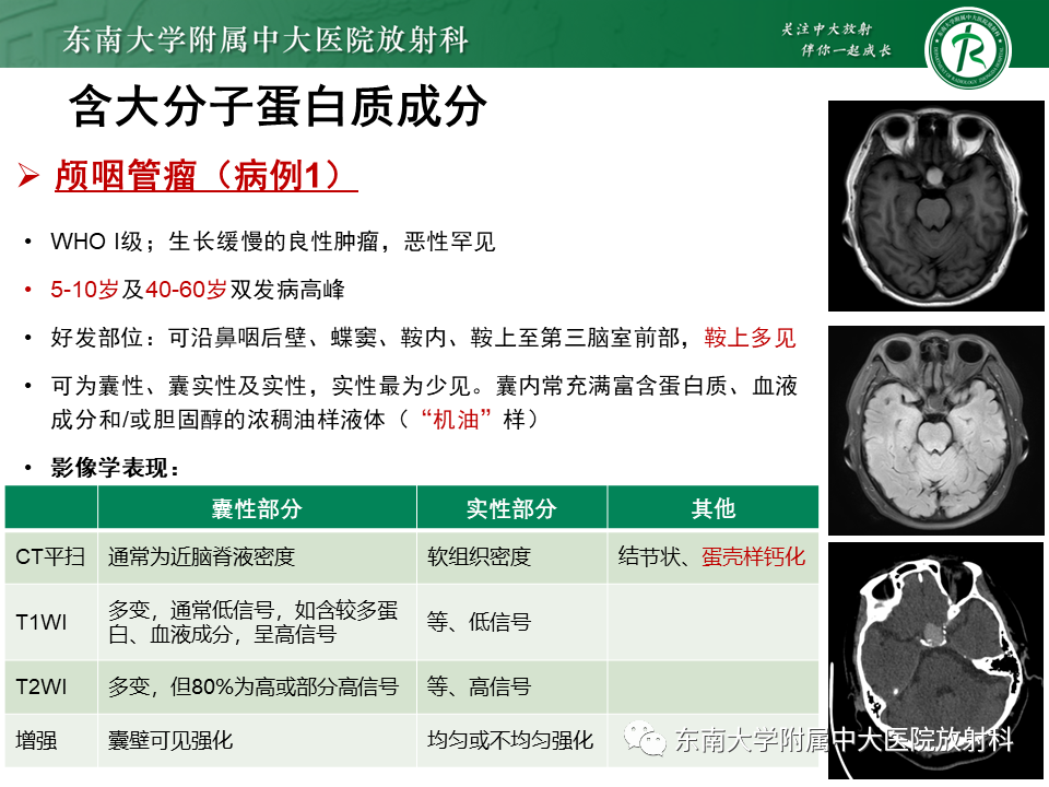 【PPT】成人颅内T1WI高信号病例随访-27