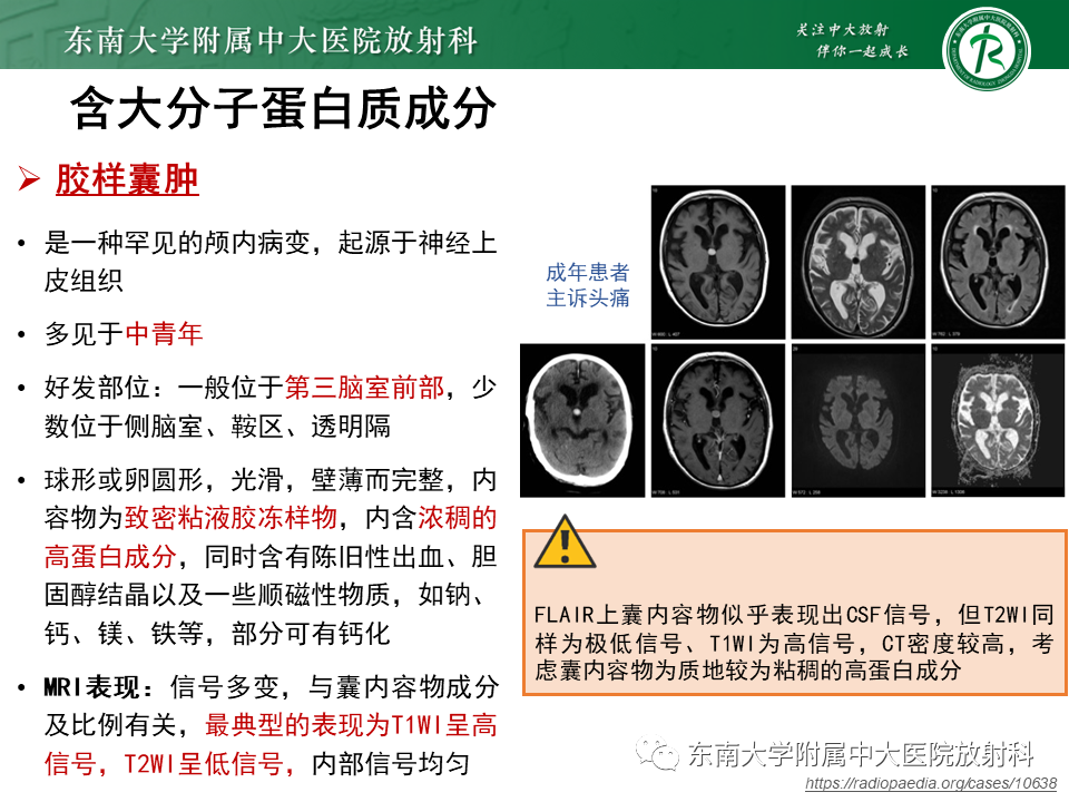 【PPT】成人颅内T1WI高信号病例随访-33