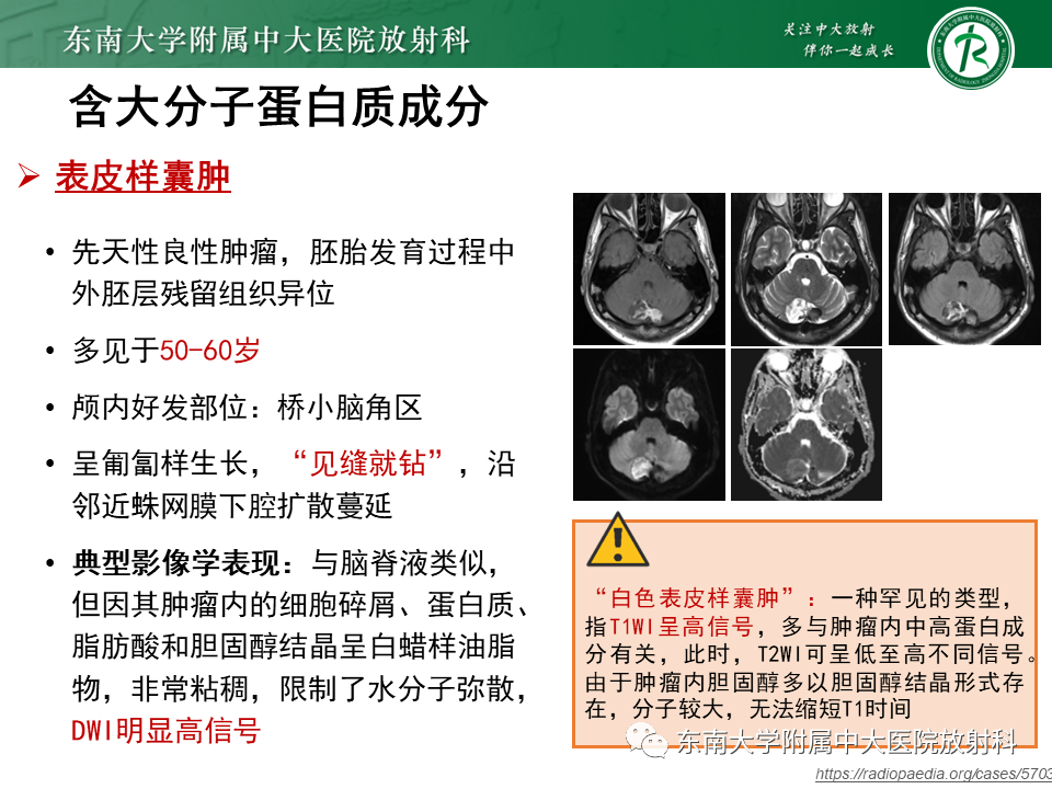 【PPT】成人颅内T1WI高信号病例随访-34