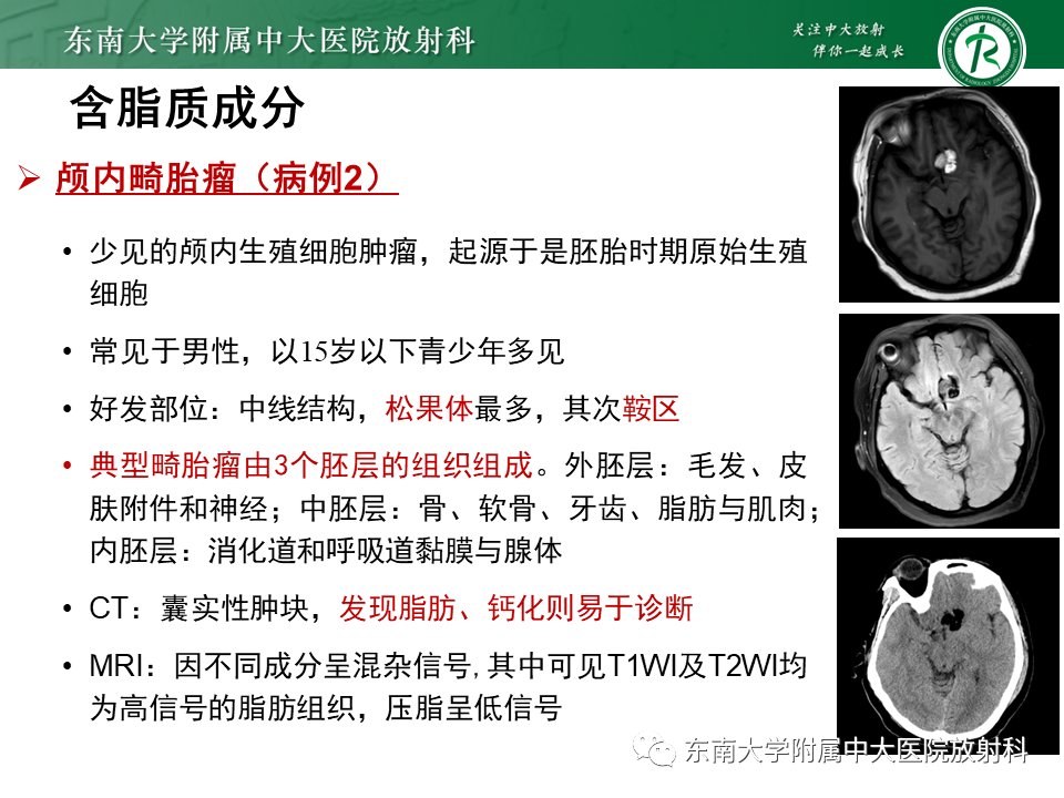 【PPT】成人颅内T1WI高信号病例随访-38