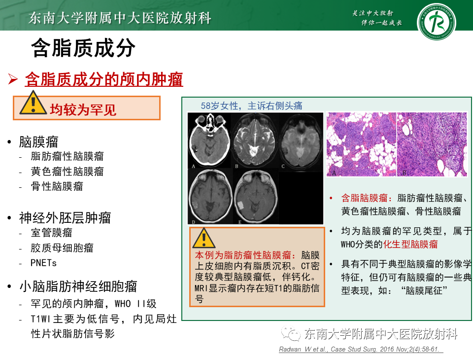 【PPT】成人颅内T1WI高信号病例随访-40