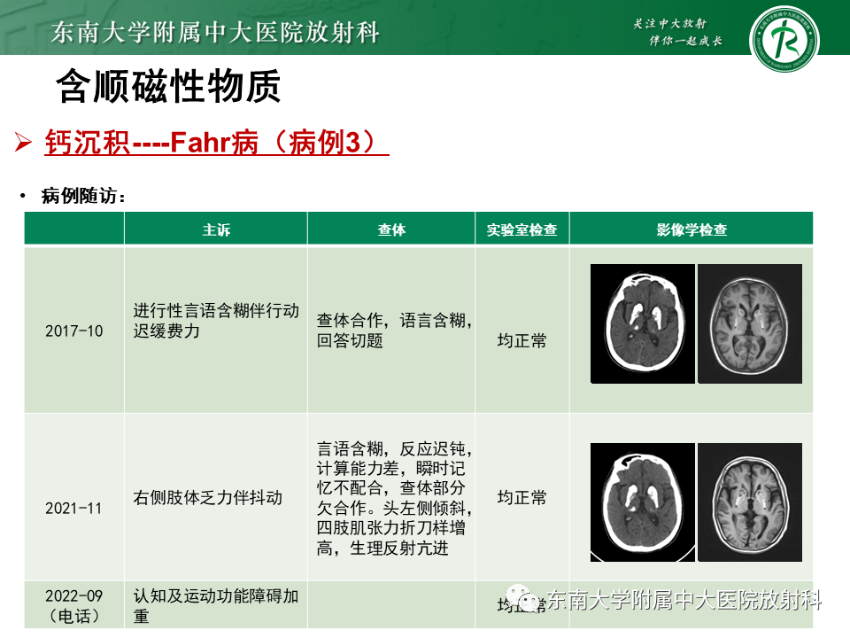 【PPT】成人颅内T1WI高信号病例随访-43