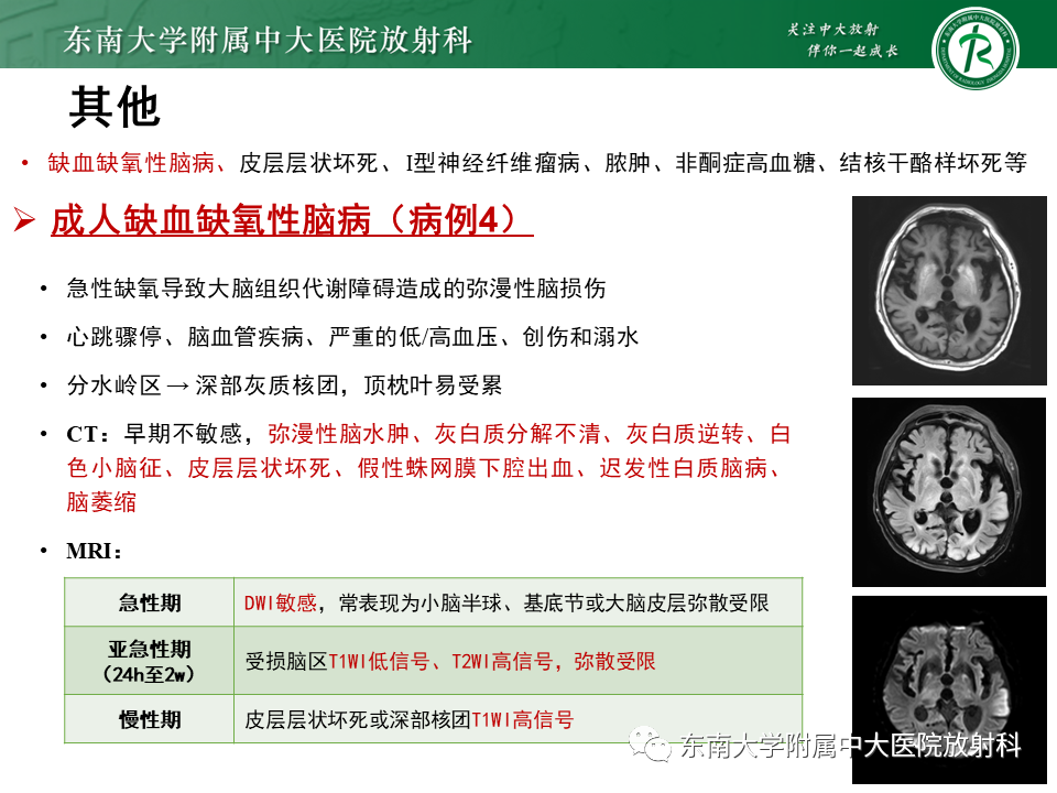 【PPT】成人颅内T1WI高信号病例随访-49