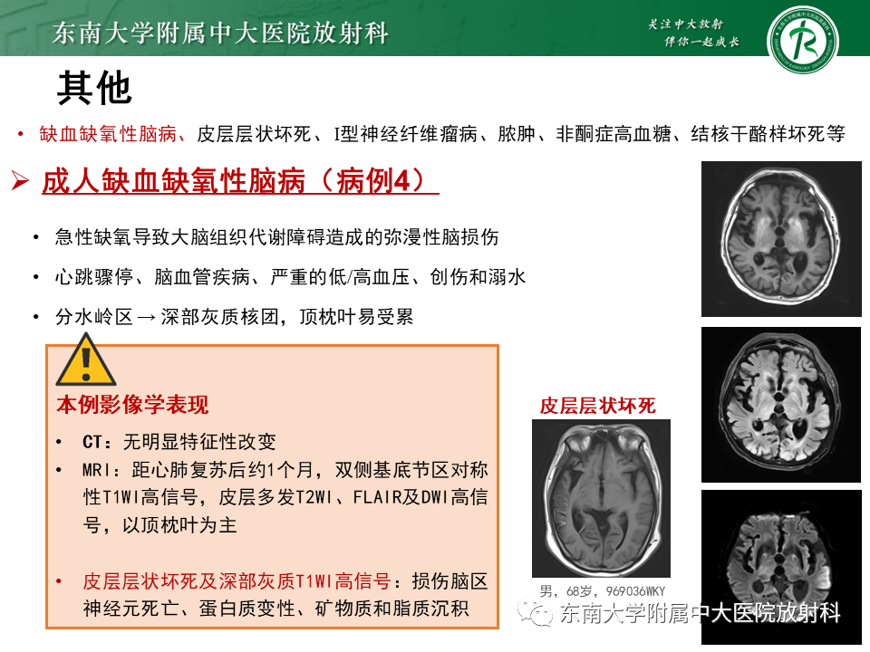 【PPT】成人颅内T1WI高信号病例随访-50