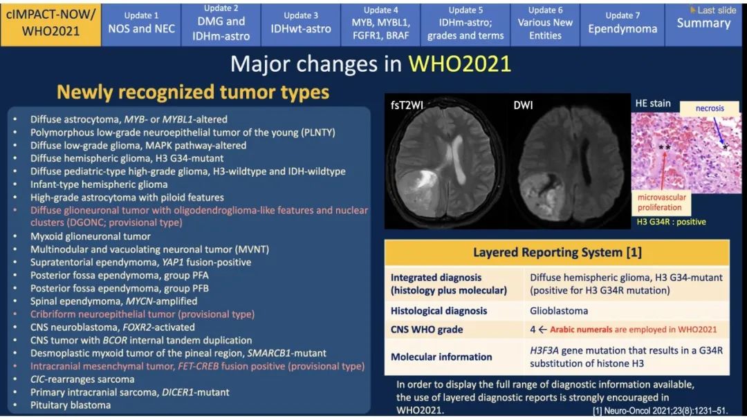 【PPT】中枢神经系统肿瘤的MRI表现：随cIMPACT-NOW一同展望WHO2021分类-7
