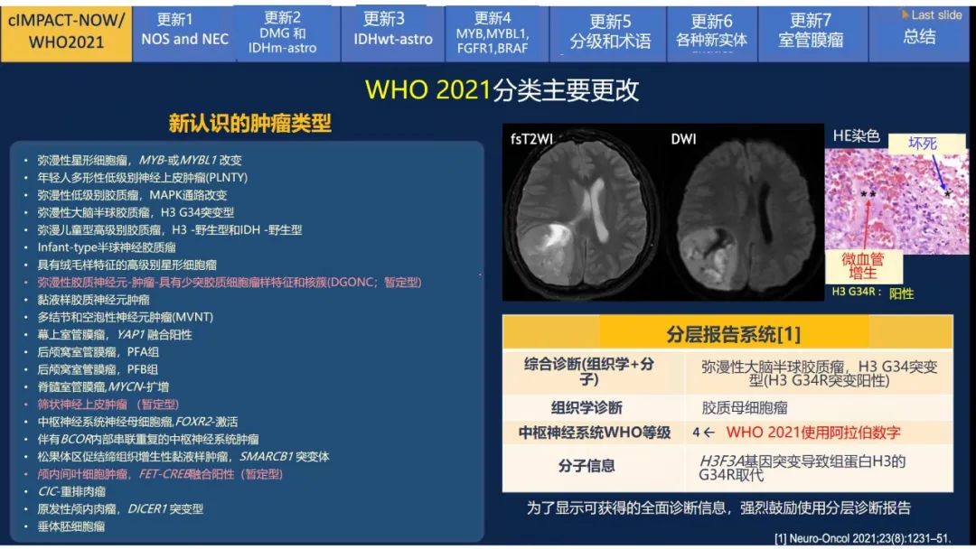 【PPT】中枢神经系统肿瘤的MRI表现：随cIMPACT-NOW一同展望WHO2021分类-8