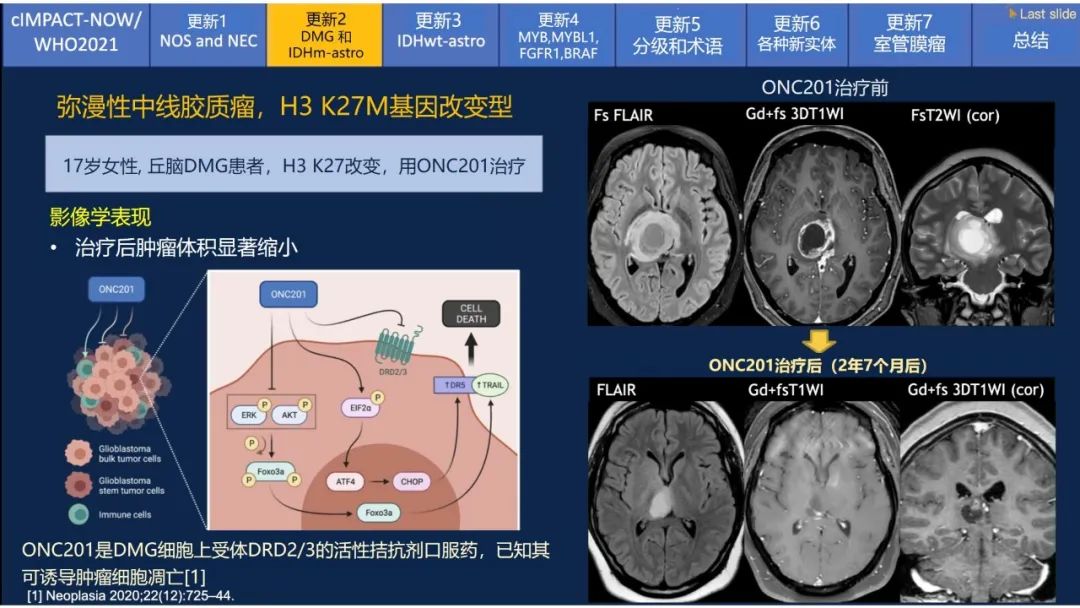 【PPT】中枢神经系统肿瘤的MRI表现：随cIMPACT-NOW一同展望WHO2021分类-16