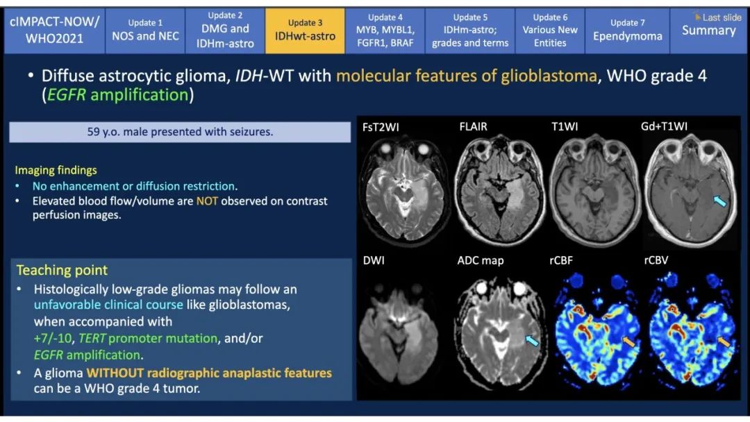 【PPT】中枢神经系统肿瘤的MRI表现：随cIMPACT-NOW一同展望WHO2021分类-21