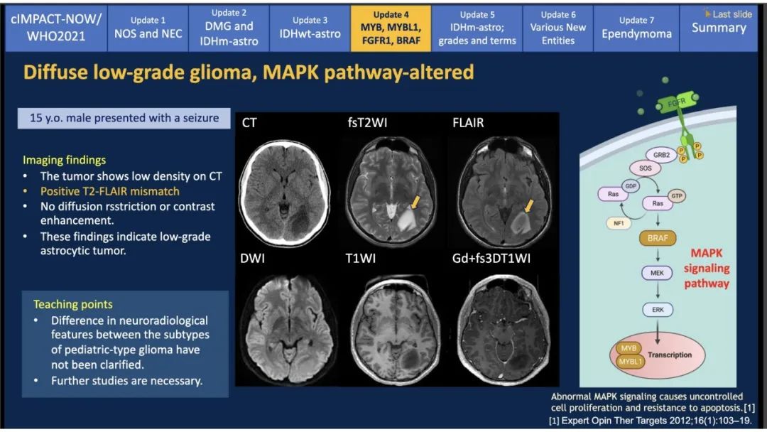 【PPT】中枢神经系统肿瘤的MRI表现：随cIMPACT-NOW一同展望WHO2021分类-29