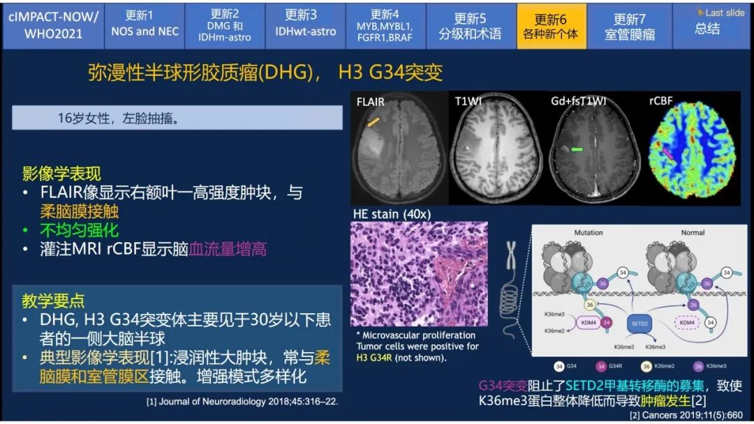 【PPT】中枢神经系统肿瘤的MRI表现：随cIMPACT-NOW一同展望WHO2021分类-38