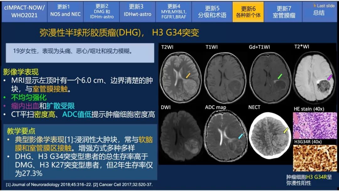 【PPT】中枢神经系统肿瘤的MRI表现：随cIMPACT-NOW一同展望WHO2021分类-40