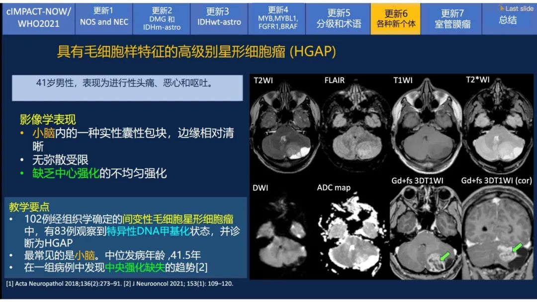 【PPT】中枢神经系统肿瘤的MRI表现：随cIMPACT-NOW一同展望WHO2021分类-42