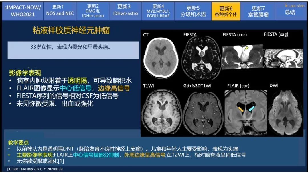 【PPT】中枢神经系统肿瘤的MRI表现：随cIMPACT-NOW一同展望WHO2021分类-44
