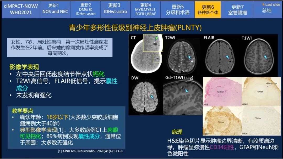 【PPT】中枢神经系统肿瘤的MRI表现：随cIMPACT-NOW一同展望WHO2021分类-46