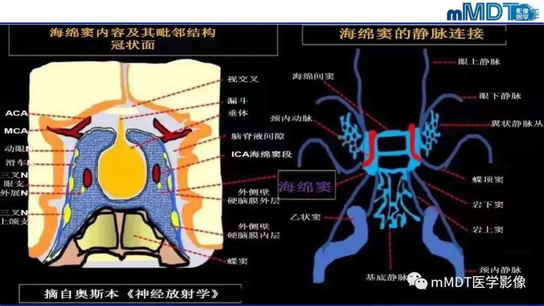 【PPT】双侧海绵窦结节病—神经结节病综述-13