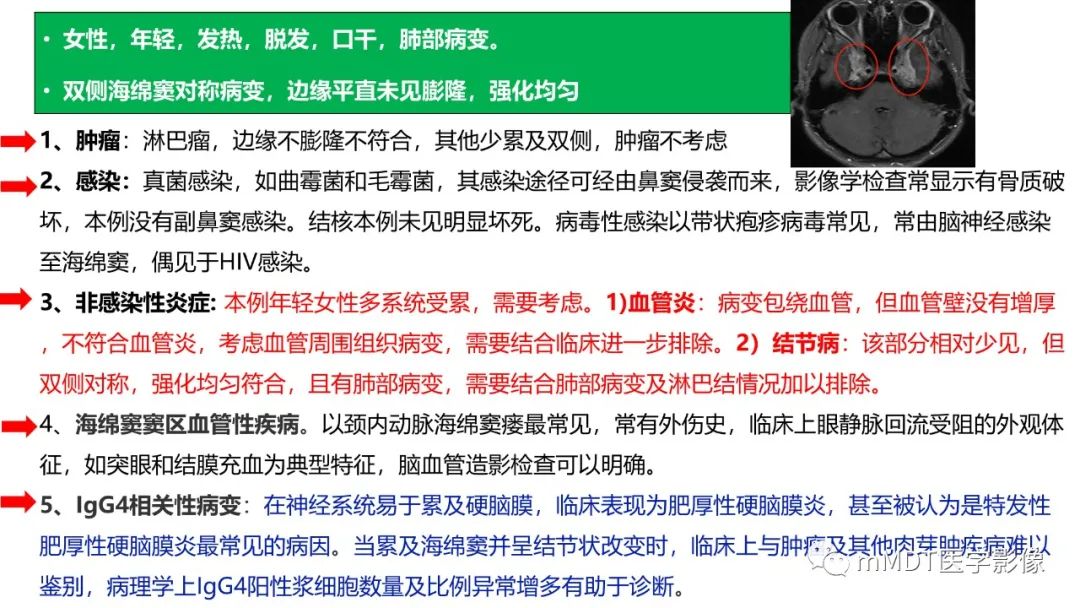 【PPT】双侧海绵窦结节病—神经结节病综述-18