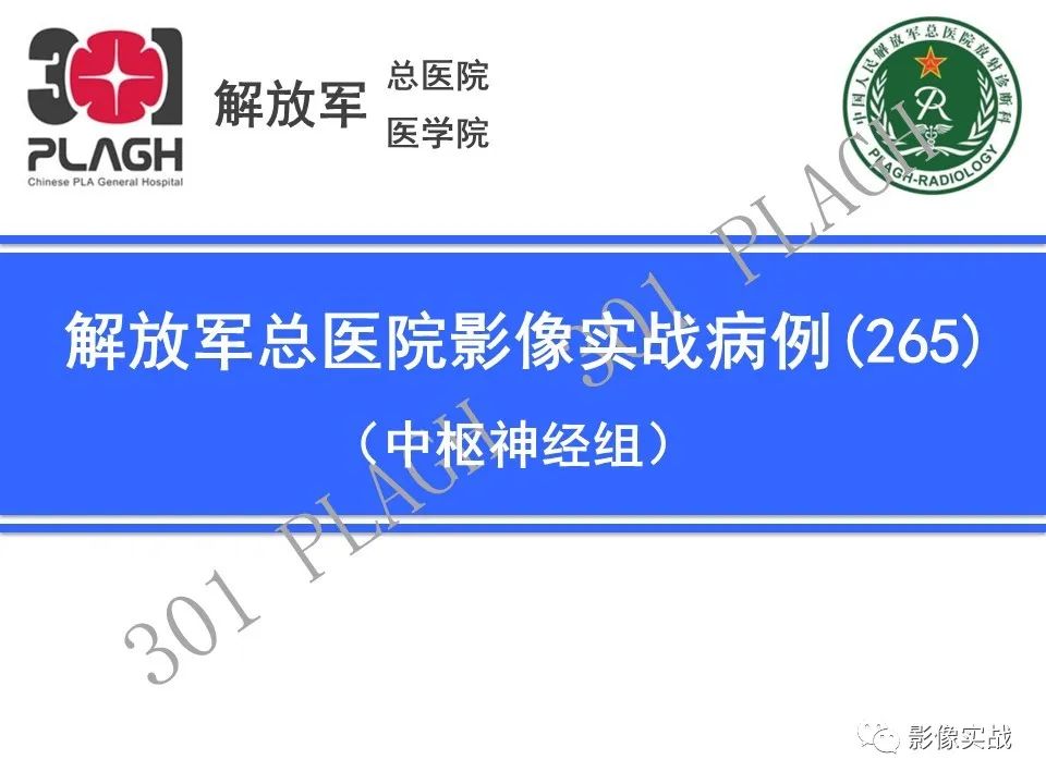 【病例】成人小脑髓母细胞瘤1例MR影像-1