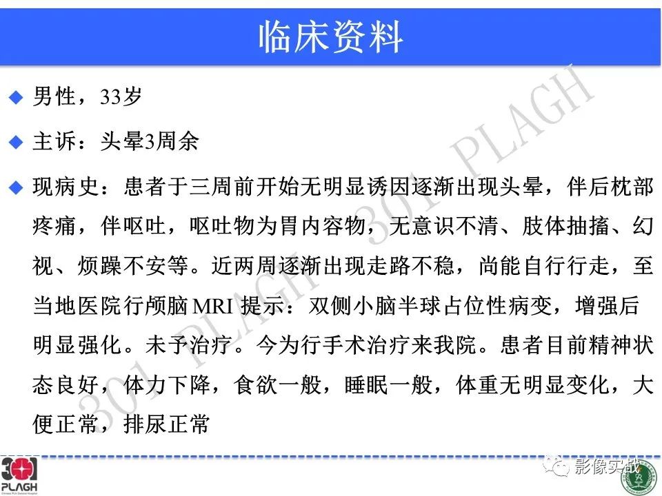 【病例】成人小脑髓母细胞瘤1例MR影像-2