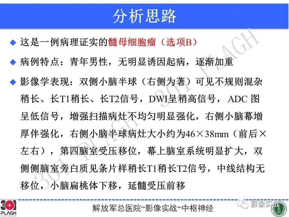 【病例】成人小脑髓母细胞瘤1例MR影像-13