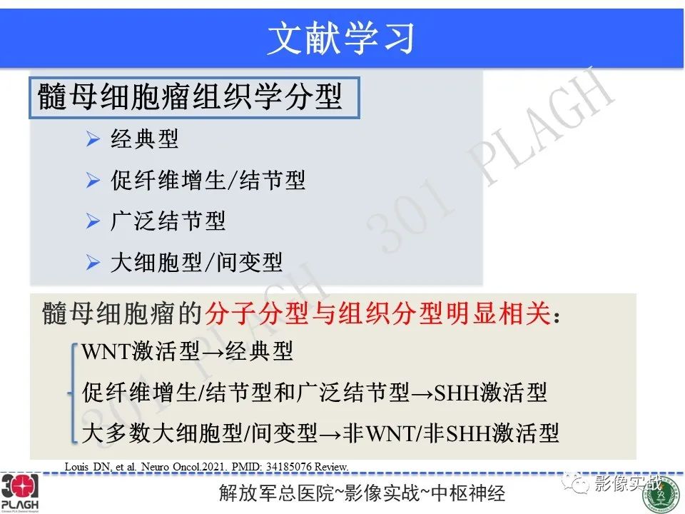 【病例】成人小脑髓母细胞瘤1例MR影像-21