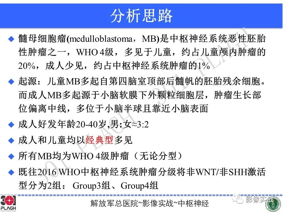 【病例】成人小脑髓母细胞瘤1例MR影像-23