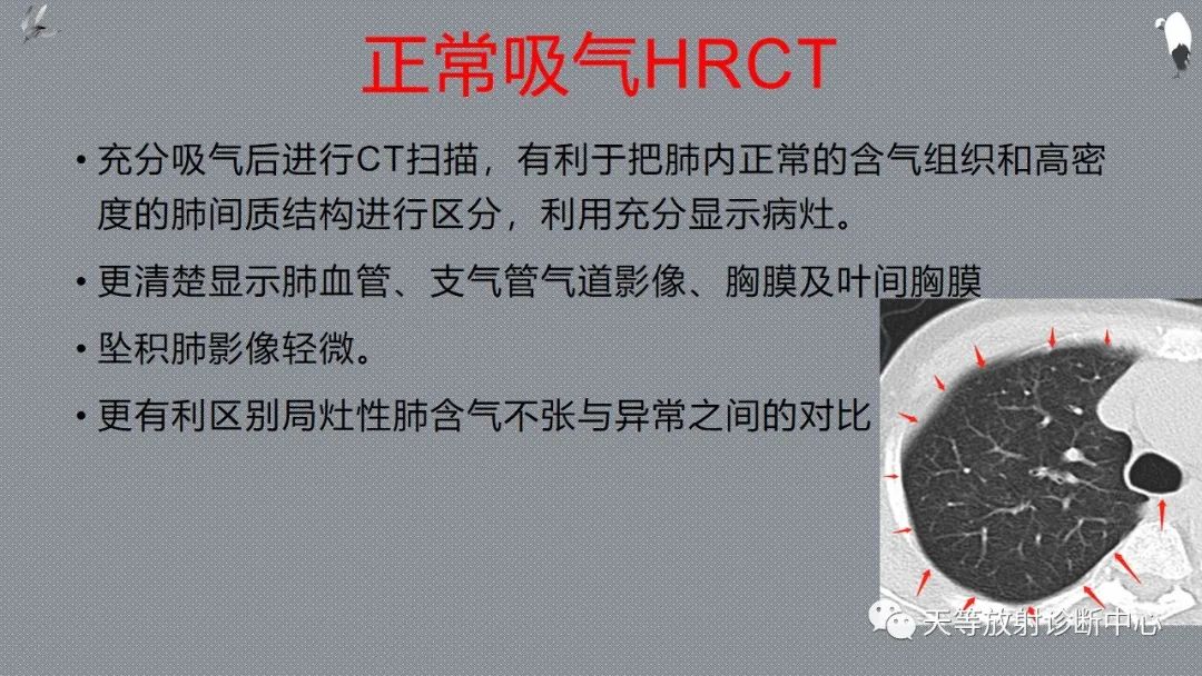 正常吸气及呼气HRCT表现—探索小叶性含气增多影像学-5