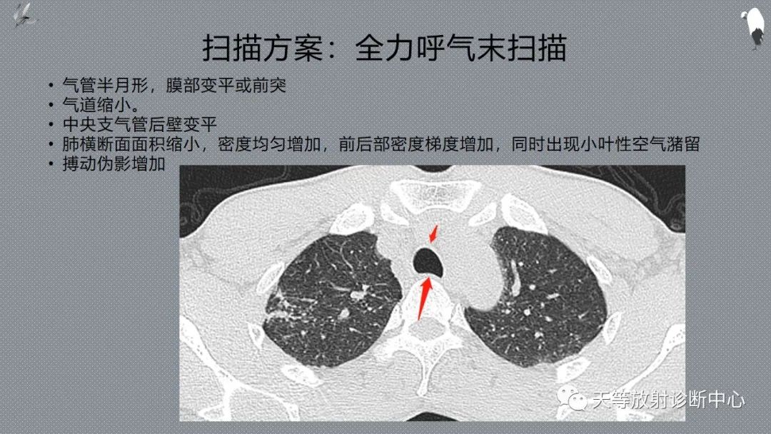 正常吸气及呼气HRCT表现—探索小叶性含气增多影像学-11