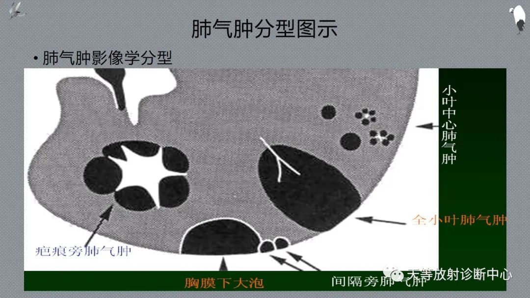 正常吸气及呼气HRCT表现—探索小叶性含气增多影像学-33