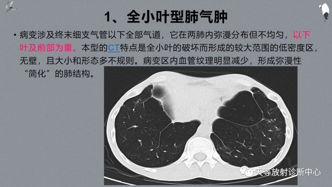 正常吸气及呼气HRCT表现—探索小叶性含气增多影像学-34