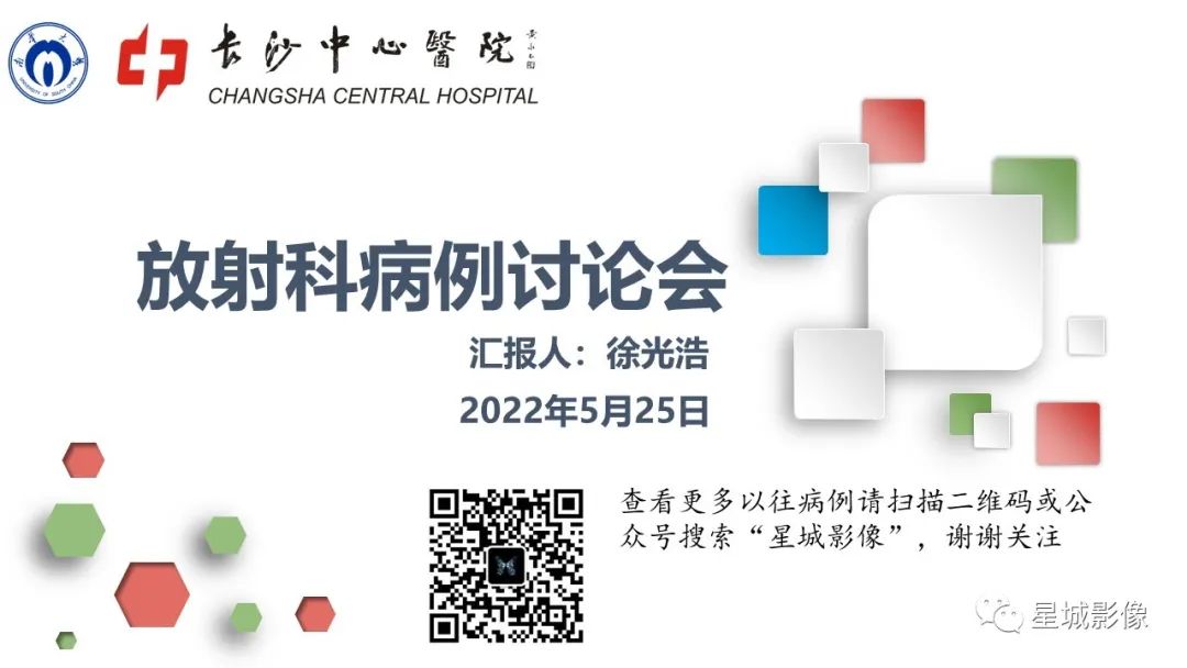 【病例】颅内成熟性囊性畸胎瘤1例MR影像表现-1