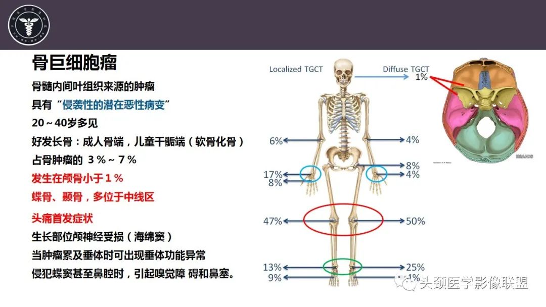 【病例】斜坡区骨巨细胞瘤 VS 脊索瘤-10