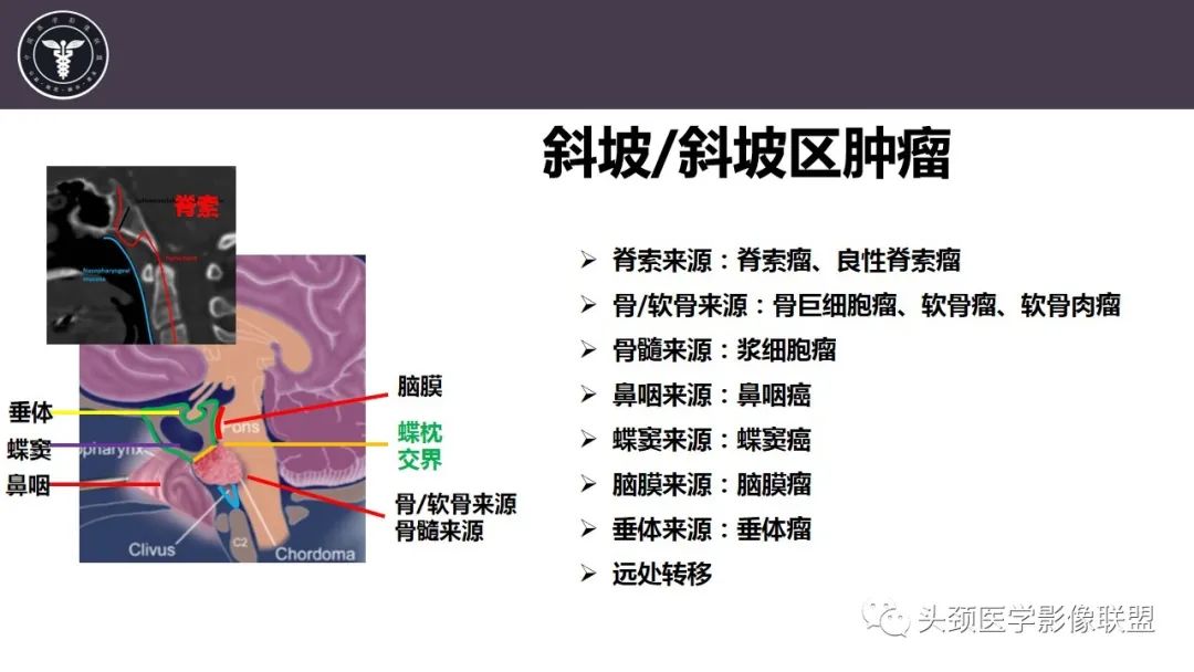 【病例】斜坡区骨巨细胞瘤 VS 脊索瘤-15