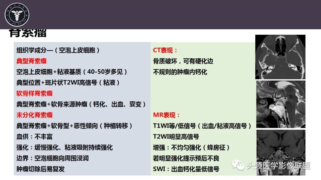 【病例】斜坡区骨巨细胞瘤 VS 脊索瘤-21